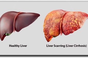লিভার ভালো রাখতে যে কাজগুলো করা জরুরি