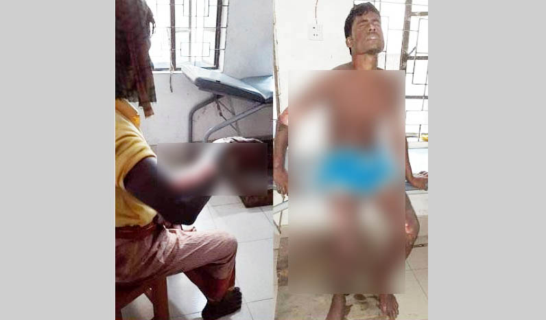 ভোলার মেঘনায় ট্রলারে গ্যাস সিলিন্ডার বিস্ফোরন: দগ্ধ ২