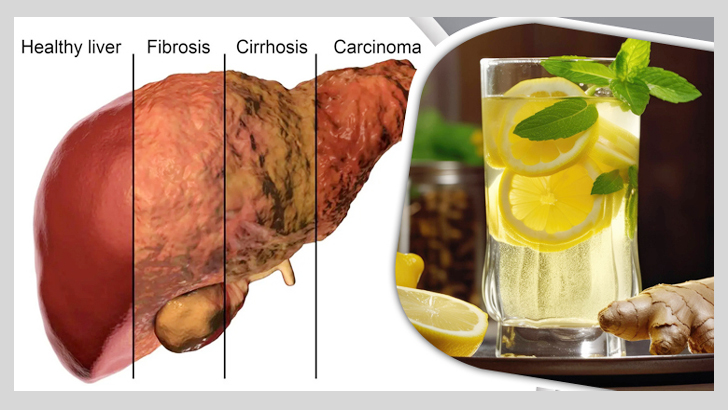 লিভার সুস্থ রাখতে যা পান করবেন