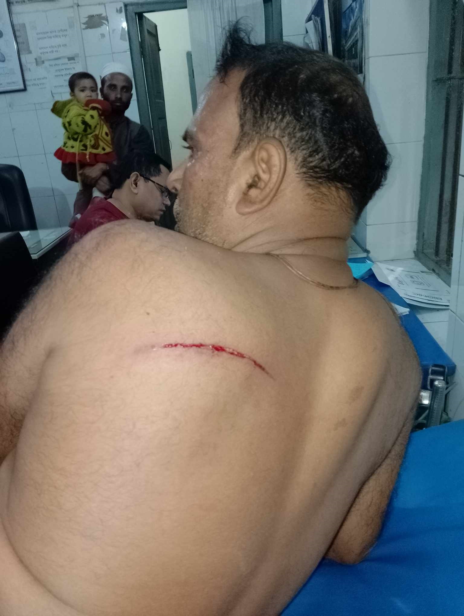 মৌলভীবাজারে পৈতৃক সম্পত্তি নিয়ে দুই ভাইয়ের মধ্যে রক্তক্ষয়ী সংঘর্ষে আহত ২