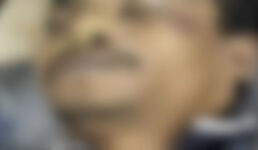 যশোরে লাঠির আঘাতে ইজিবাইক চালক নিহত