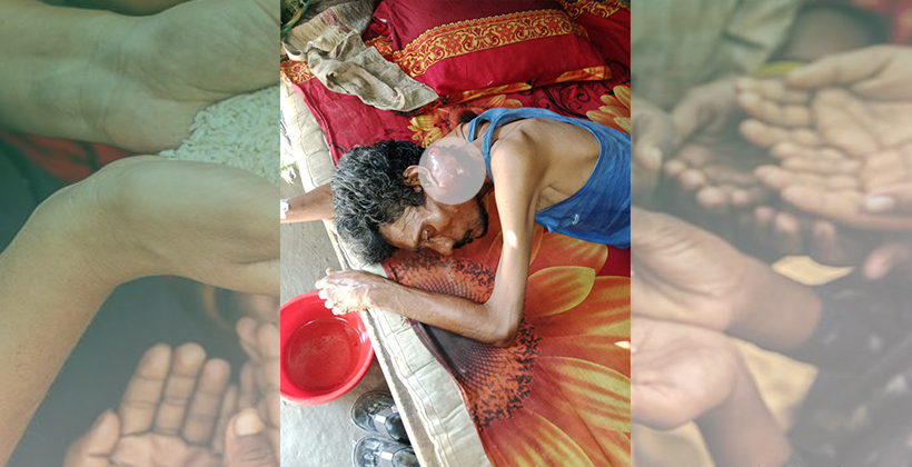 ঘাড়ের টিউমার ক্যানসারে রূপ-বাঁচতে চায় জহরুল, প্রয়োজন সমাজের সাহায্যের হাত”
