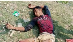 উখিয়া সীমান্তে আবারও মাইন বিস্ফোরণে রোহিঙ্গা যুবকের পা বিচ্ছিন্ন