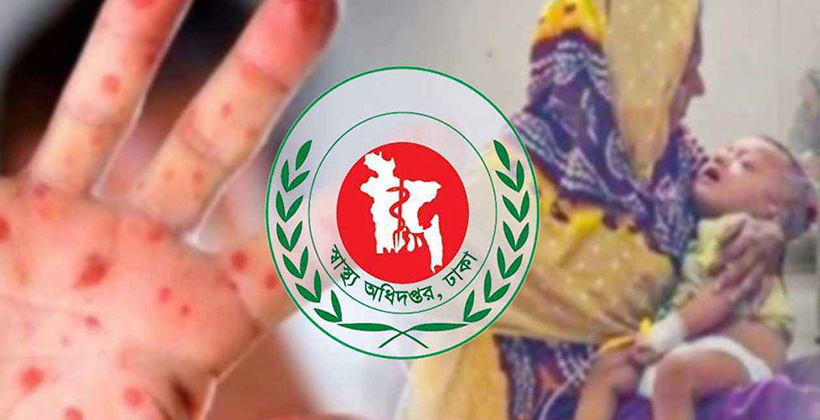 “হাম উপসর্গে আরও তিনজনের মৃত্যু, নতুন আক্রান্ত ১২১৮”